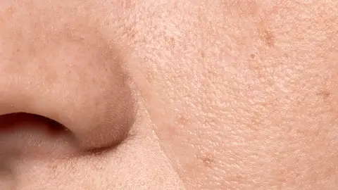 Poros de la cara Poros de la cara