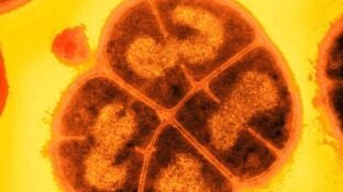 Conan, el microbio indestructible: c&oacute;mo es la bacteria que aniquilar&iacute;a a cualquier ser vivo