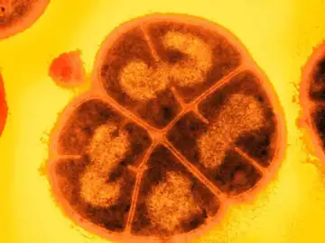 Conan, el microbio indestructible: cómo es la bacteria que aniquilaría a cualquier ser vivo Conan, el microbio indestructible: cómo es la bacteria que aniquilaría a cualquier ser vivo