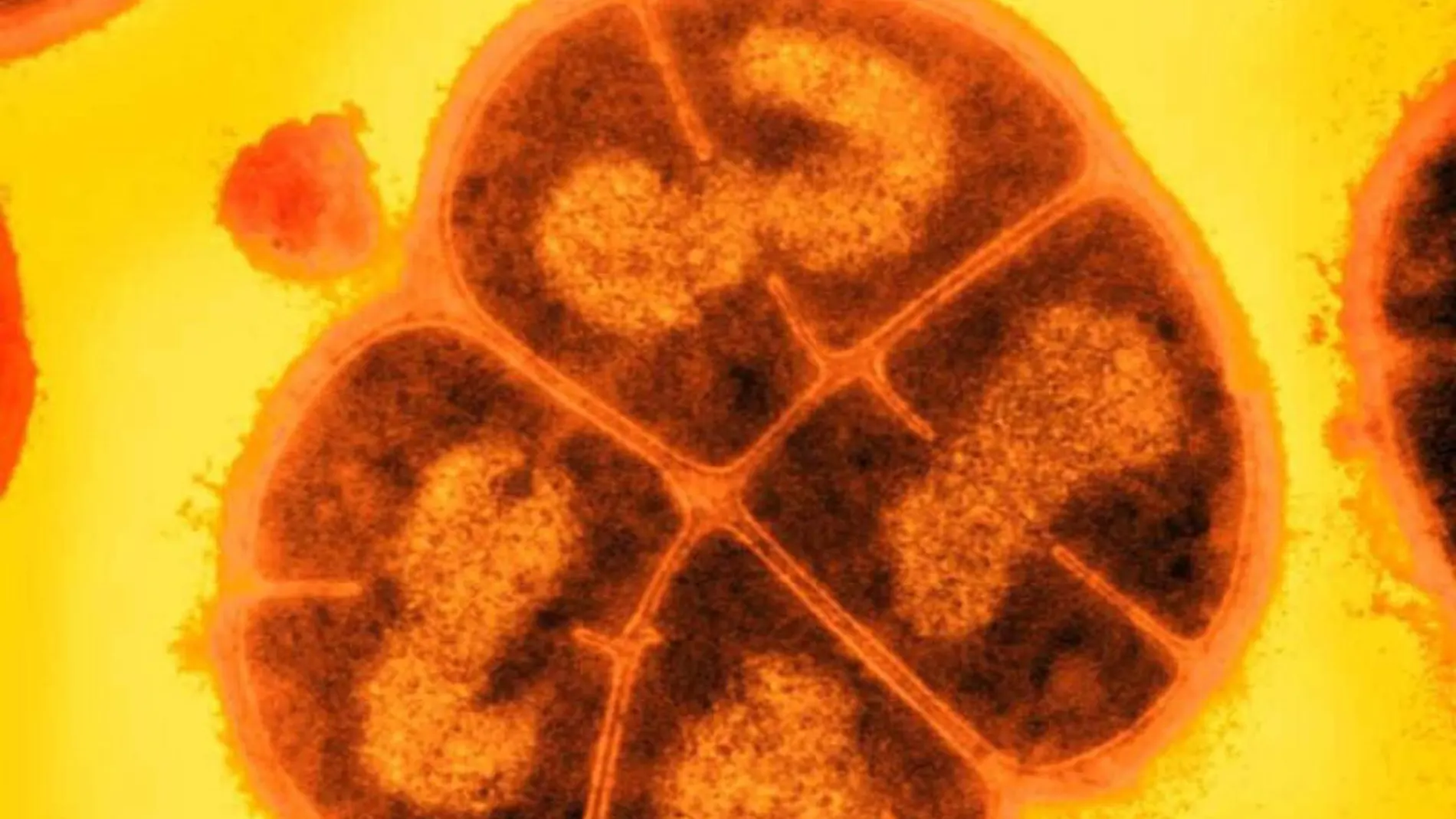 Conan, el microbio indestructible: cómo es la bacteria que aniquilaría a cualquier ser vivo Conan, el microbio indestructible: cómo es la bacteria que aniquilaría a cualquier ser vivo