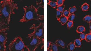 Ensayan una nueva tecnolog&iacute;a no invasiva que ataca espec&iacute;ficamente a las c&eacute;lulas cancerosas y suprime su capacidad tumoral