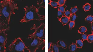 Ensayan una nueva tecnología no invasiva que ataca específicamente a las células cancerosas y suprime su capacidad tumoral Ensayan una nueva tecnología no invasiva que ataca específicamente a las células cancerosas y suprime su capacidad tumoral