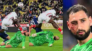 El momento de la patada de Singo en la cara de Donnarumma El momento de la patada de Singo en la cara de Donnarumma