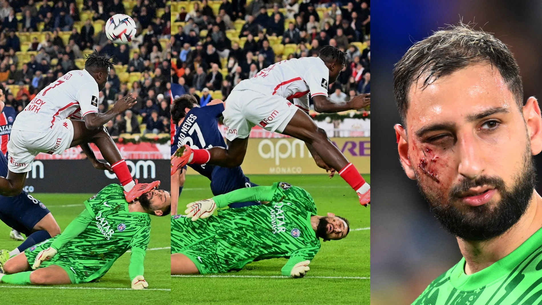 El momento de la patada de Singo en la cara de Donnarumma El momento de la patada de Singo en la cara de Donnarumma