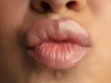 Labios voluminosos Labios voluminosos