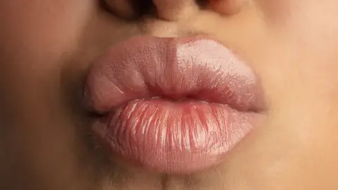 Labios voluminosos Labios voluminosos