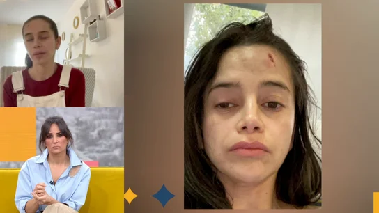 Karla, camarera agredida. Karla, camarera agredida.