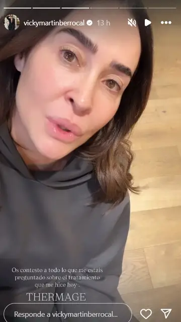 Vicky Martín Berrocal después de la sesión de radiofrecuencia Vicky Martín Berrocal después de la sesión de radiofrecuencia