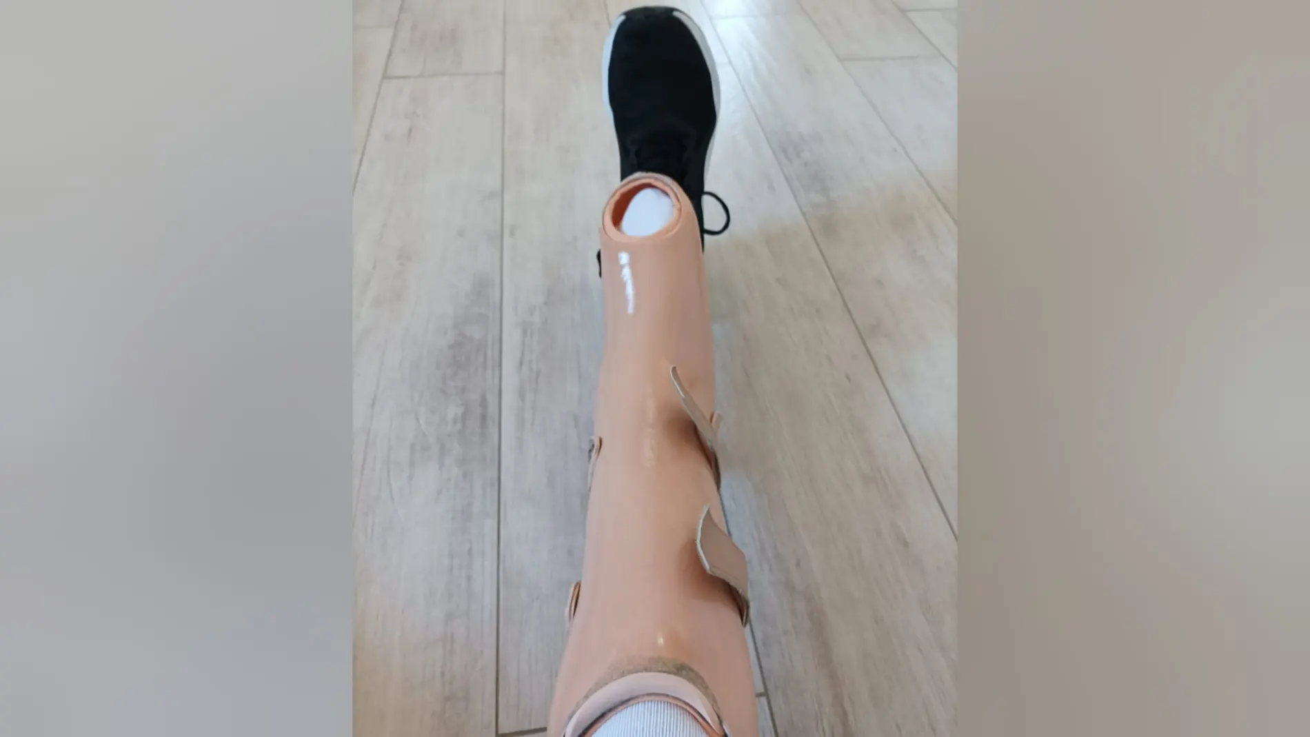 La prótesis de pierna extraviada a José Manuel en Chiclana La prótesis de pierna extraviada a José Manuel en Chiclana