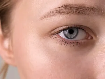 Mujer con ojeras Mujer con ojeras