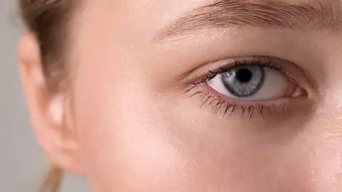 Mujer con ojeras Mujer con ojeras