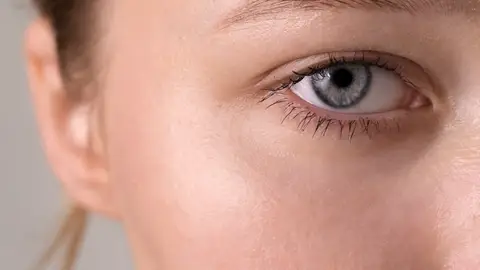 Mujer con ojeras Mujer con ojeras