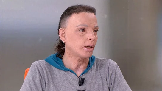 Jan Millastre Jan Millastre