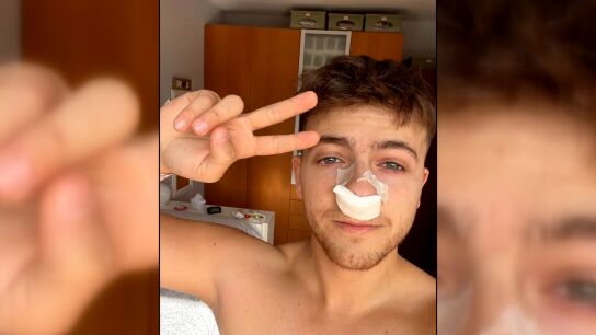 Adicci&oacute;n al spray nasal