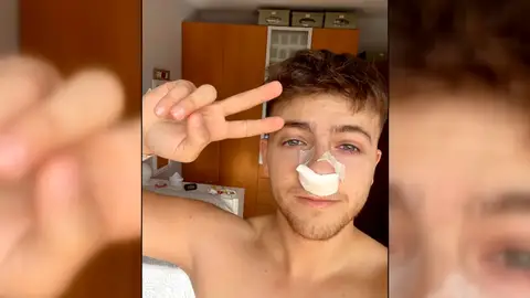 Adicción al spray nasal Adicción al spray nasal