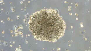 Cient&iacute;ficos del CSIC describen un nuevo mecanismo molecular que modifica la eficacia de la quimioterapia
