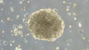 Científicos del CSIC describen un nuevo mecanismo molecular que modifica la eficacia de la quimioterapia Científicos del CSIC describen un nuevo mecanismo molecular que modifica la eficacia de la quimioterapia