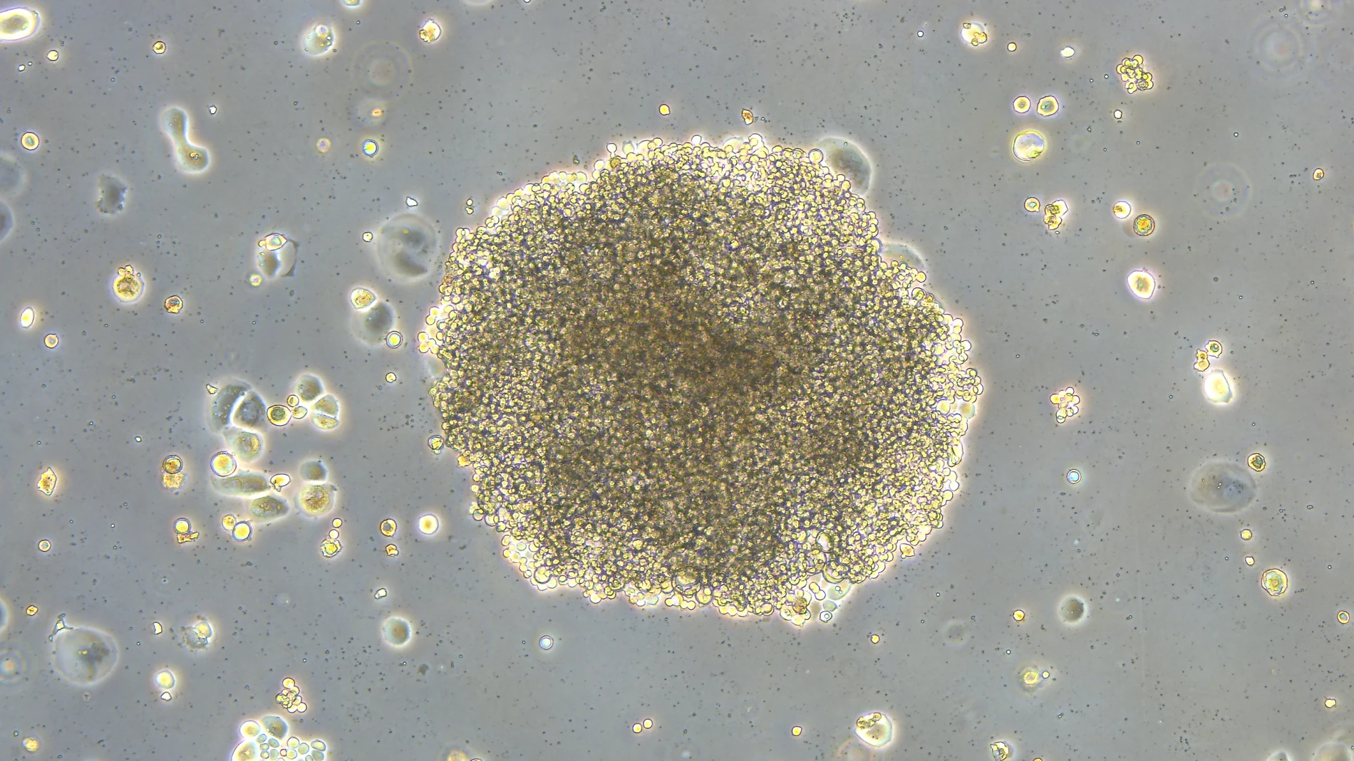 Científicos del CSIC describen un nuevo mecanismo molecular que modifica la eficacia de la quimioterapia Científicos del CSIC describen un nuevo mecanismo molecular que modifica la eficacia de la quimioterapia