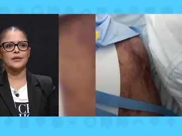 Cirugía estética. Cirugía estética.