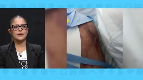 Cirugía estética. Cirugía estética.