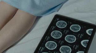 Cient&iacute;ficos descubren un "interruptor" molecular que revierte las c&eacute;lulas cancerosas