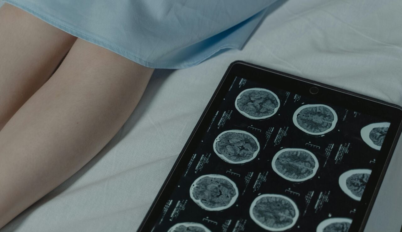 Cient&iacute;ficos descubren un "interruptor" molecular que revierte las c&eacute;lulas cancerosas