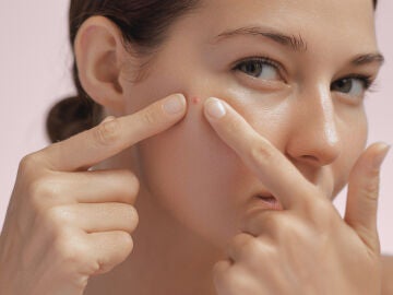 Mujer con un grano en la cara