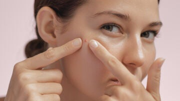 Mujer con un grano en la cara