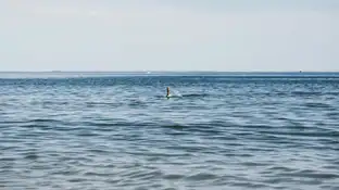 Una turista pierde las manos tras el ataque de un tiburón en el Caribe Una turista pierde las manos tras el ataque de un tiburón en el Caribe