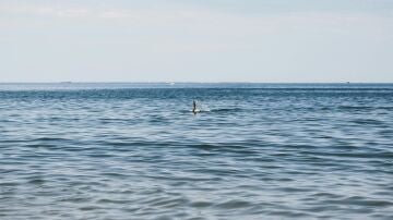 Una turista pierde las manos tras el ataque de un tiburón en el Caribe