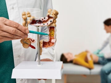 C&aacute;ncer de colon