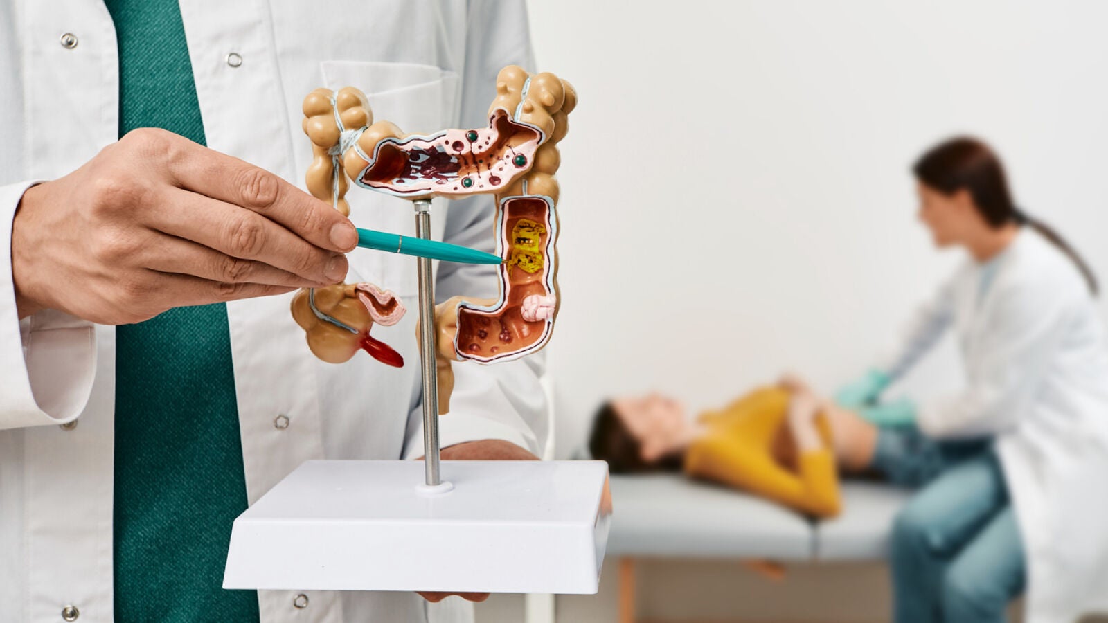 Un sencillo test de farmacia puede ayudar a diagnosticar el cáncer de colon