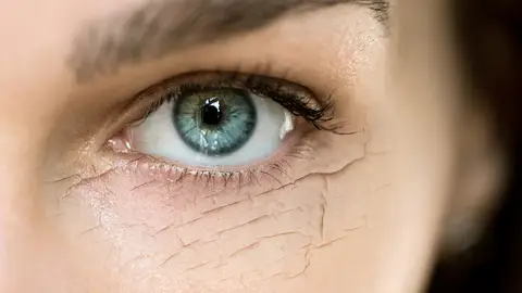 Ojera cuarteada Ojera cuarteada