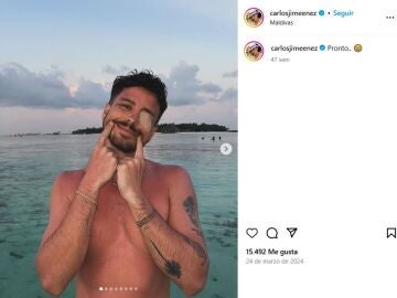 Carlos Jim&eacute;nez