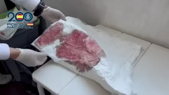Así era la "sala de los horrores" en la que se realizaban las cirugías Así era la "sala de los horrores" en la que se realizaban las cirugías