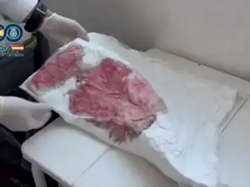 Así era la "sala de los horrores" en la que se realizaban las cirugías Así era la "sala de los horrores" en la que se realizaban las cirugías