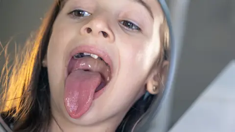 Niña mostrando las amígdalas Niña mostrando las amígdalas