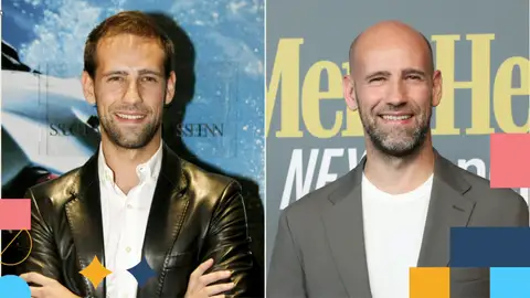 Gonzalo Miró, sobre la calvicie Gonzalo Miró, sobre la calvicie