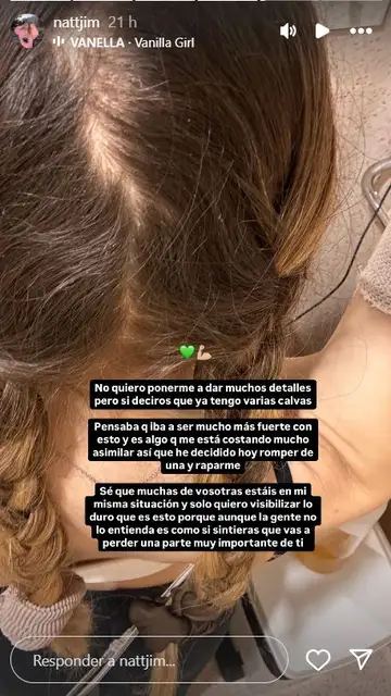 La influencer Natalia Jiménez explicando que ha decidido raparse La influencer Natalia Jiménez explicando que ha decidido raparse