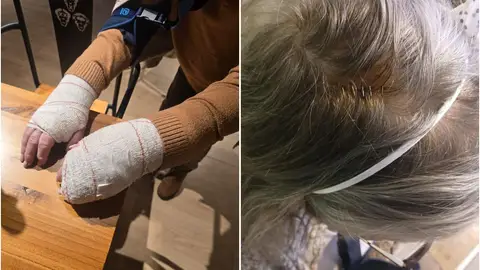 Imágenes de la agresión Imágenes de la agresión