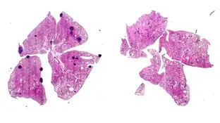 Tumores de mama de ratón que desarrollaron cáncer metastásico en los pulmones Tumores de mama de ratón que desarrollaron cáncer metastásico en los pulmones