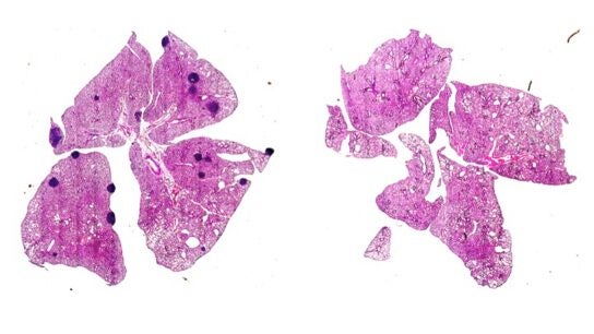 Tumores de mama de rat&oacute;n que desarrollaron c&aacute;ncer metast&aacute;sico en los pulmones