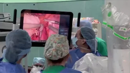 Primer trasplante renal de donante vivo mediante cirugía robótica Primer trasplante renal de donante vivo mediante cirugía robótica