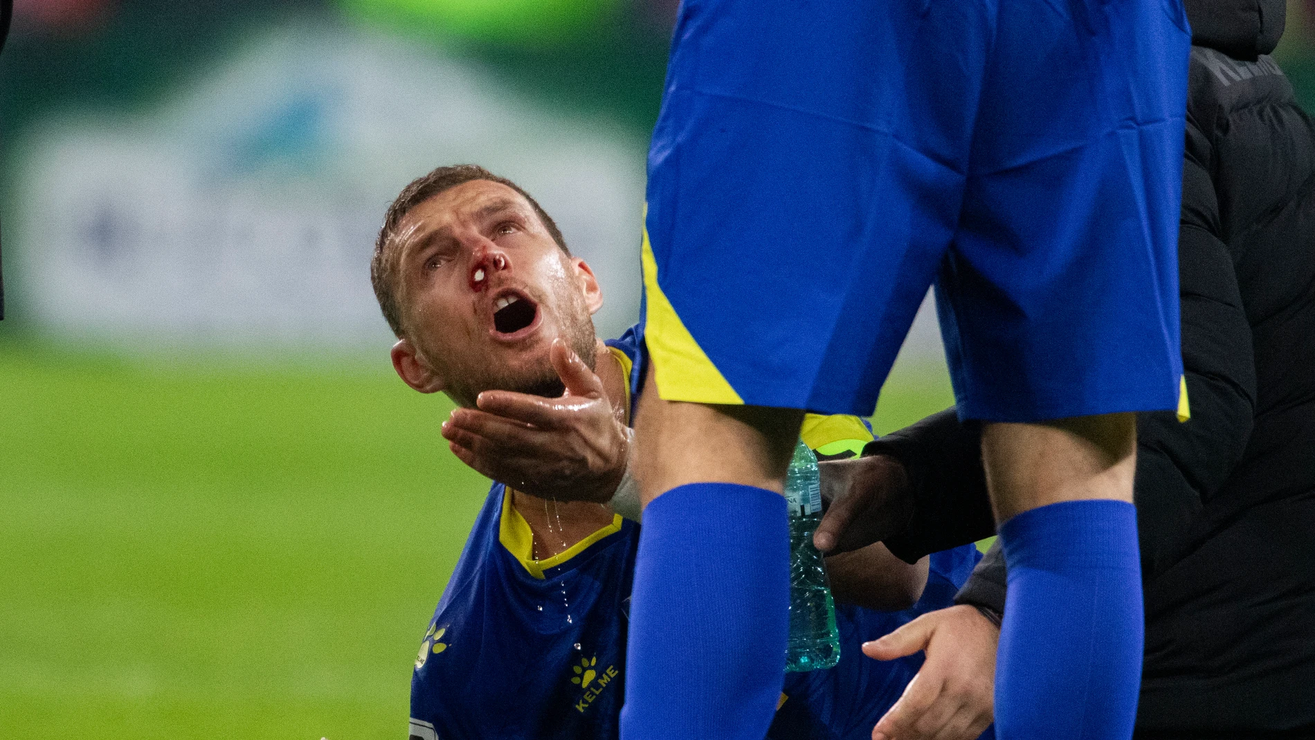 Edin Dzeko, tras la patada recibida ante Rumanía Edin Dzeko, tras la patada recibida ante Rumanía