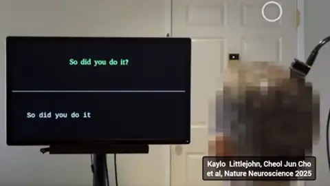 Vuelve a hablar 18 años después de sufrir un ictus gracias a una prótesis cerebral de inteligencia artificial Vuelve a hablar 18 años después de sufrir un ictus gracias a una prótesis cerebral de inteligencia artificial