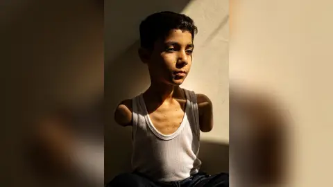 Foto sobre las secuelas de la guerra en los niños gazatíes que ha ganado el World Press Photo global Foto sobre las secuelas de la guerra en los niños gazatíes que ha ganado el World Press Photo global