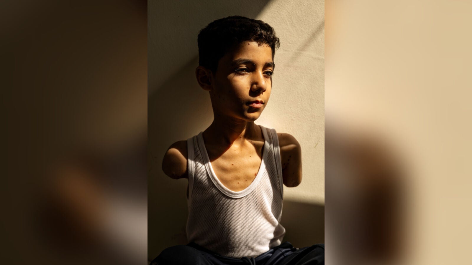 La imagen de un niño gazatí mutilado en un ataque de Israel es elegida como la Foto del Año