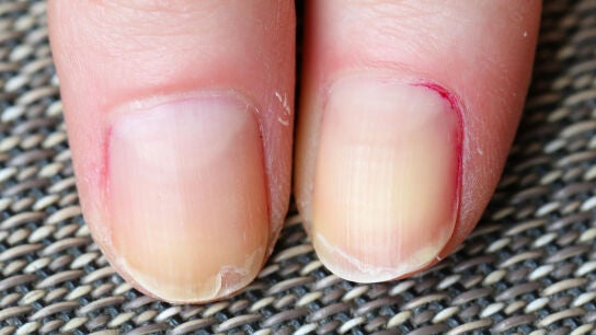 U&ntilde;as rotas