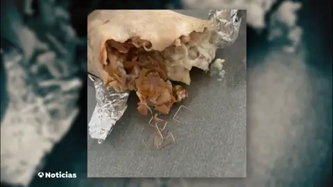 Una menor ingresa de urgencia en el hospital tras comer un dúrum con grapas metálicas que compró en un local Una menor ingresa de urgencia en el hospital tras comer un dúrum con grapas metálicas que compró en un local