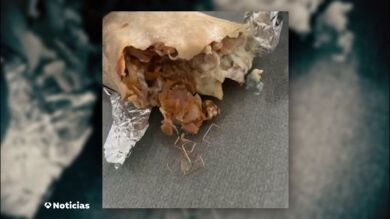 Una menor ingresa de urgencia en el hospital tras comer un dúrum con grapas metálicas que compró en un local